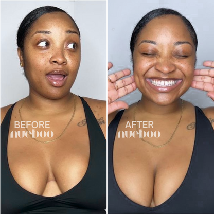 Easy Lift Adhesive Bra